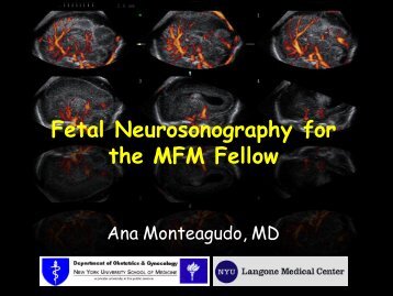 3D Fetal Neurosonography