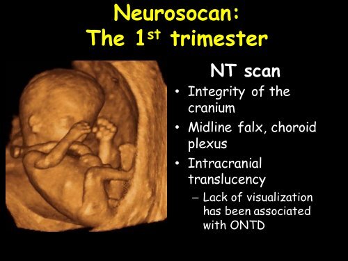 3D Fetal Neurosonography