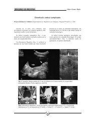 Divertículo uretral complicado 68 - Revista EXPERIENCIA MÉDICA