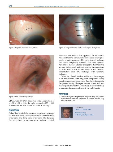 672 CASE REPORT: NEGATIVE
