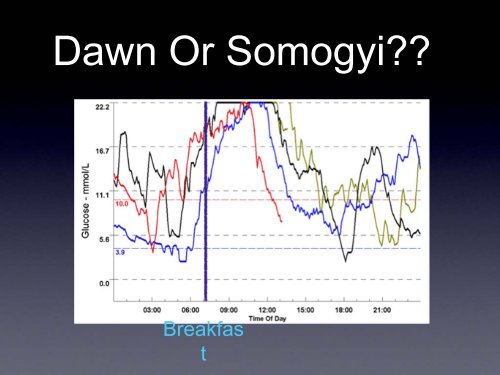 What happens to blood glucose overnight - Dr Pratik ... - Dafne