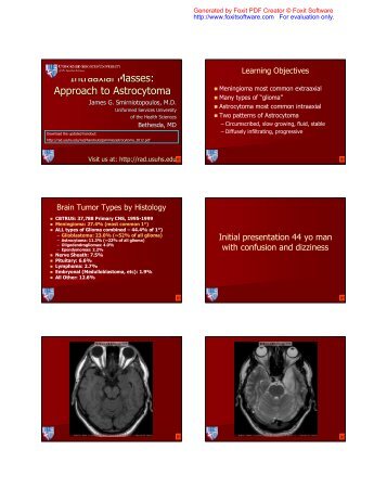 Intraaxial Masses: Approach to Astrocytoma - Radiology - Uniformed ...