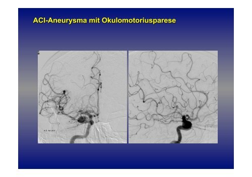 Prof. Dr. med. Gerhard Schuierer Zentrale Neuropathien!