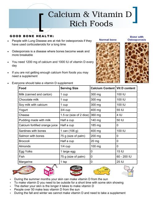 Calcium and Vitamin D Rich Foods - Chronic Disease Network ...