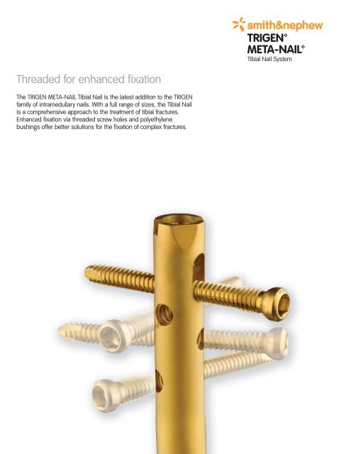 Interlocking Nails and Minimally Invasive Osteosynthesis