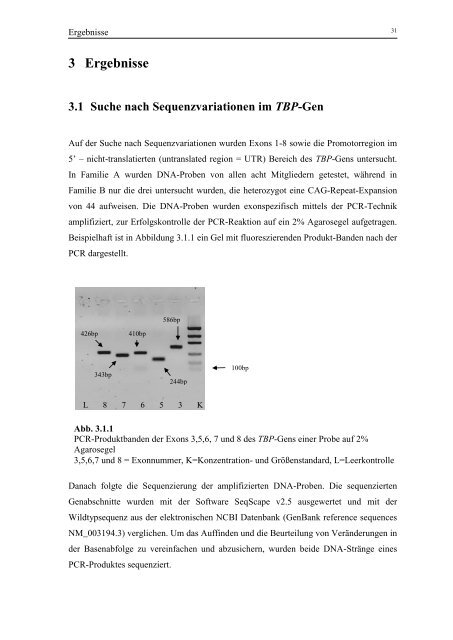 Spinozerebelläre Ataxie Typ 17: Suche nach modifizierenden ...