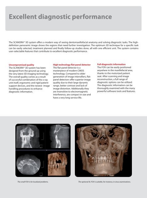 Brochure - Soredex