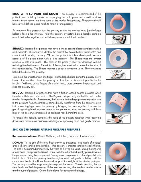 Ring Pessary Size Chart