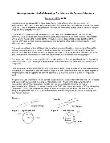 Nomogram for Limbal Relaxing Incisions with Cataract Surgery