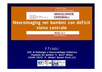 Neuroimaging nei bambini con deficit visivo centrale Neuroimaging ...