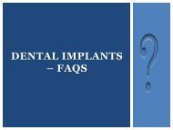 Dental Implants – A Permanent Solution for Missing Tooth