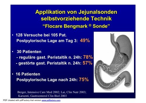 Applikation von Jejunalsonden - AKE