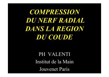 Compression du nerf radial au coude - ClubOrtho.fr