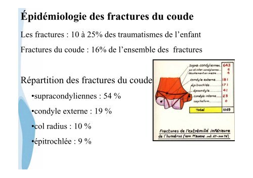 Les fractures du coude de l'enfant - CHU de Rouen