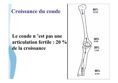 Les fractures du coude de l'enfant - CHU de Rouen