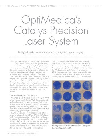 OptiMedica's Catalys Precision Laser System
