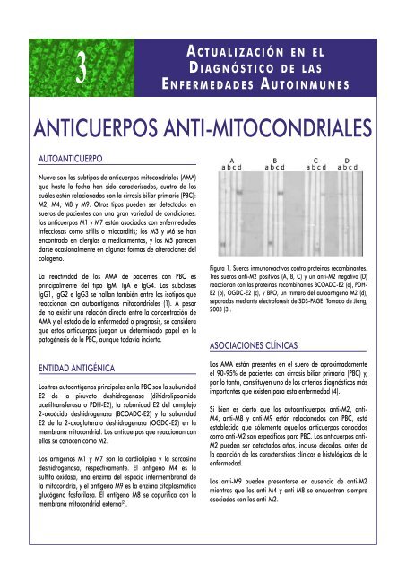 anticuerpos anti-mitocondriales