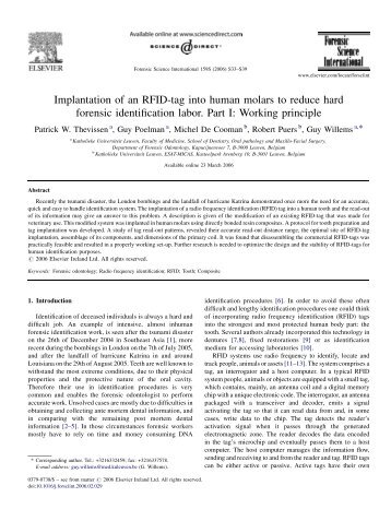 Implantation of an RFID-tag into human molars to ... - KU Leuven