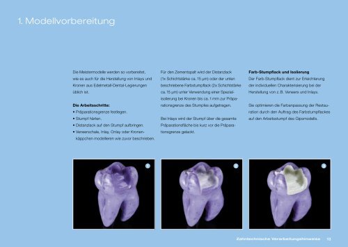 Cergo Gebrauchsanweisung - DeguDent GmbH