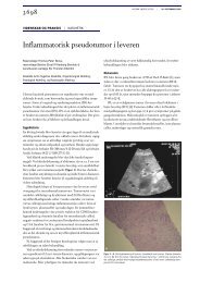 Inflammatorisk pseudotumor i leveren