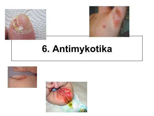 Antimykotika ( Bezug auf FuÃŸpilz, Scheidenpilz, Nagelpilz)