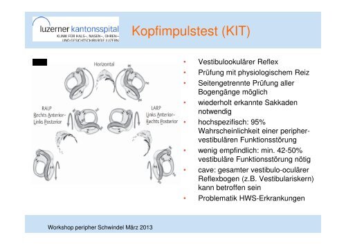 WS 4 Peripherer Schwindel