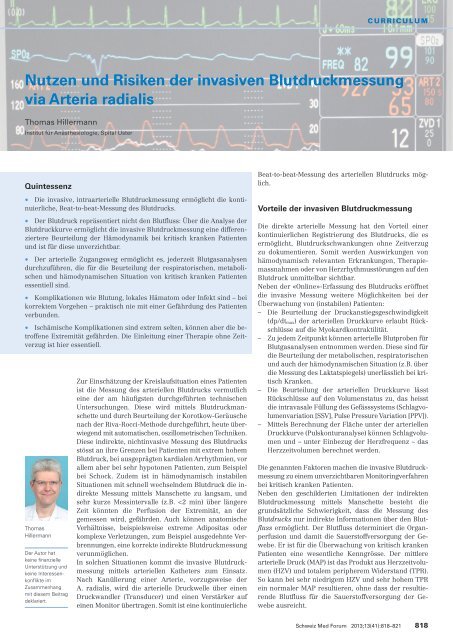 Nutzen und Risiken der invasiven Blutdruckmessung via Arteria ...