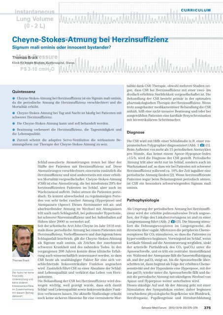 Cheyne-Stokes-Atmung bei Herzinsuffizienz - Swiss Medical Forum