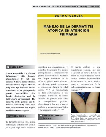 manejo de la dermatitis atópica en atención primaria - edigraphic.com
