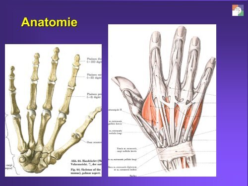 Arthritis – schmerzende Hände - Apobern.ch