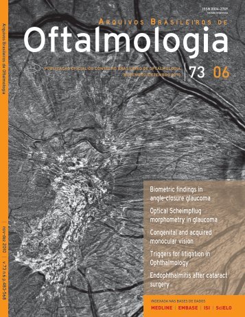 biometric findings in angle-closure glaucoma Optical Scheimpflug ...