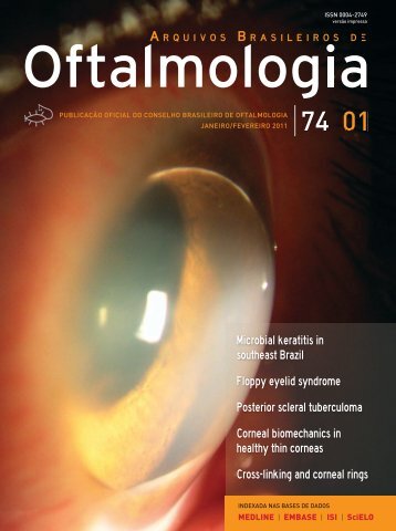 Microbial keratitis in southeast Brazil Floppy eyelid syndrome ...