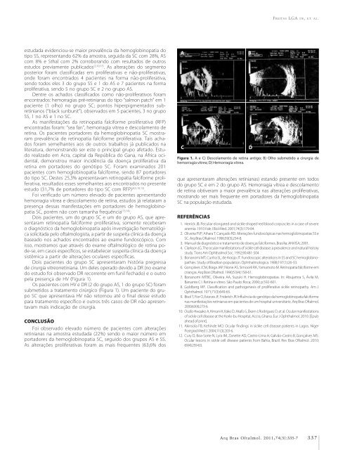 Access to cataract surgery in public and private health systems ...