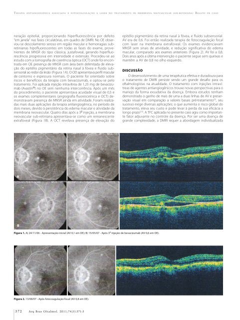 Access to cataract surgery in public and private health systems ...