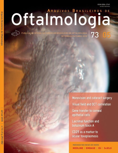 Monovision and cataract surgery Visual field and OCT correlation ...