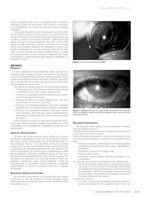 Monovision and cataract surgery Visual field and OCT correlation ...