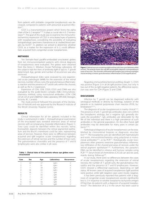 Monovision and cataract surgery Visual field and OCT correlation ...