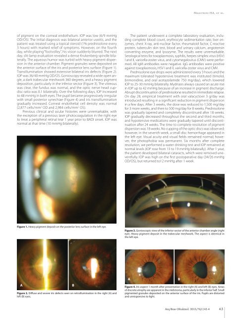 Photocoagulation versus intravitreal injection in diabetic retinopathy ...