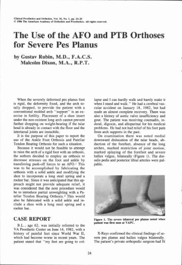 The Use of the AFO and PTB Orthoses for Severe Pes Planus