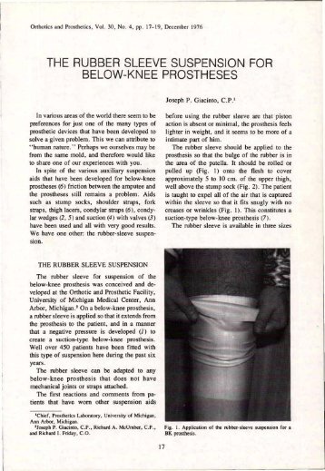 the rubber sleeve suspension for below-knee prostheses