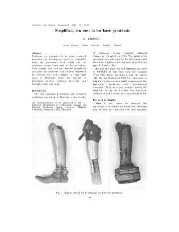 Simplified, low cost below-knee prosthesis