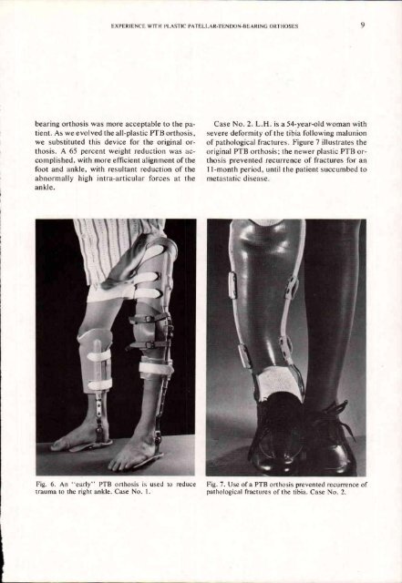 Orthotics and Prosthetics