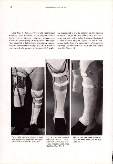 Orthotics and Prosthetics