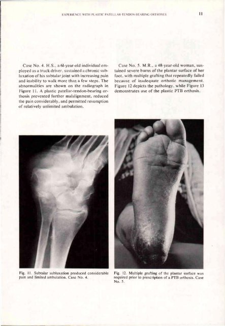 Orthotics and Prosthetics