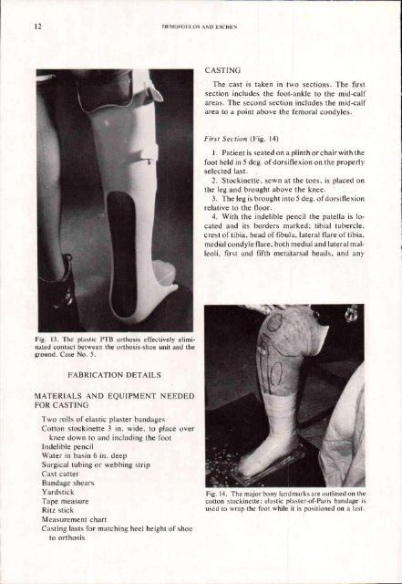 Orthotics and Prosthetics