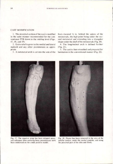 Orthotics and Prosthetics