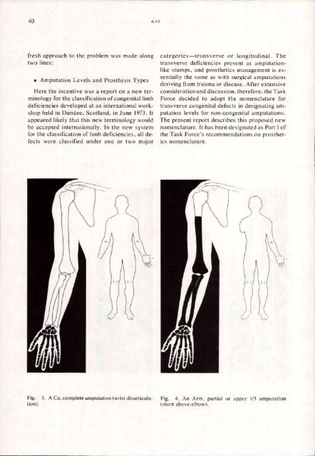 Orthotics and Prosthetics