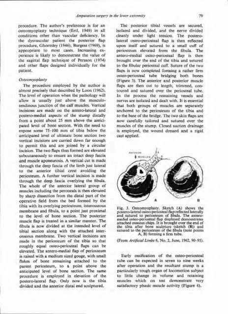 Amputation surgery in the lower extremity