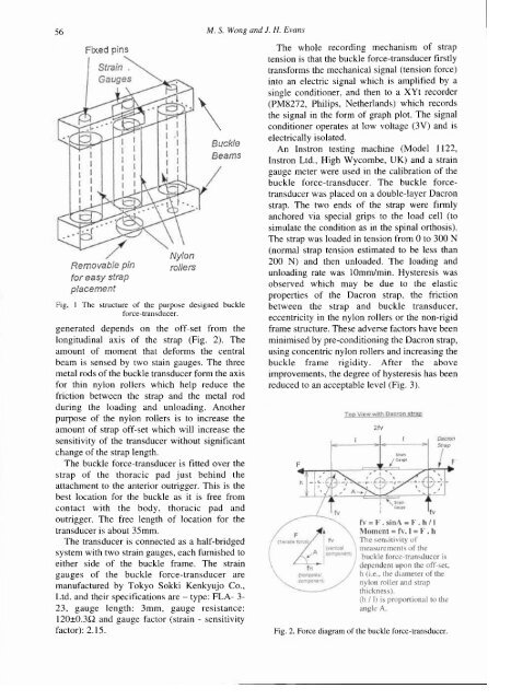 Biomechanical evaluation of the Milwaukee brace