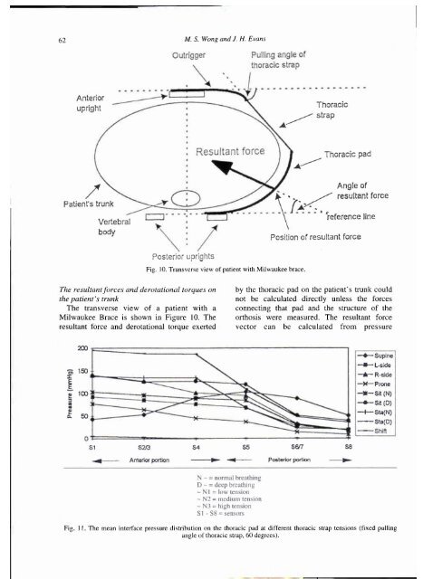 Biomechanical evaluation of the Milwaukee brace